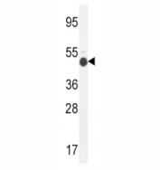 GCNT2 antibody western blot analysis in mouse kidney tissue lysate