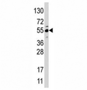 Western blot analysis of JMJD4 antibody and HepG2 lysate