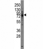 Western blot analysis of TRPV3 antibody and HL-60 lysate.