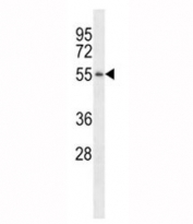 Western blot analysis of TSPY antibody pre-incubated without (Lane 1) and with (2) blocking peptide in LNCAP lysate.