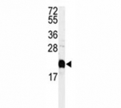 Western blot analysis of Calmodulin antibody and HeLa lysate.