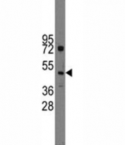 Western blot analysis of Ihh antibody and HL-60 lysate