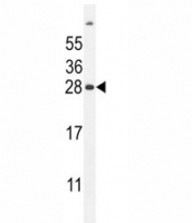 FAT10 antibody western blot analysis in mouse liver tissue lysate