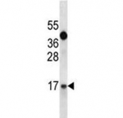 IGF1 antibody western blot analysis in A549 lysate. Predicted molecular weight ~15 kDa.
