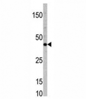 Western blot analysis of TCF7 antibody and mouse heart tissue lysate.