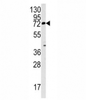 Western blot analysis of Rex1 antibody and mouse lung tissue lysate