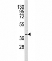 Western blot analysis of AKR1A1 antibody and Y79 lysate. Predicted molecular weight: ~37kDa.