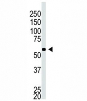 Western blot testing of BACE2C antibody and A549 cell lysate
