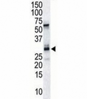The DSCR1 antibody used in western blot to detect DSCR1 in endothelial tissue lysate
