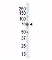 Western blot of RSKB antibody and placenta tissue lysate