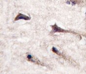 IHC analysis of FFPE human brain tissue stained with PKC beta 2 antibody