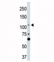 LATS2 antibody used in western blot to detect LATS2 in NIH3T3 cell lysate