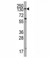 Western blot analysis of PIK3CA antibody and K562 lysate. Predicted molecular weight ~110 kDa.