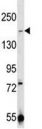 TRPM7 antibody western blot analysis in 293 lysate