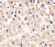 Immunohistochemical analysis of paraffin-embedded human liver using MET antibody at 1:25 dilution.