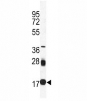 Western blot analysis of UBC9 antibody and mouse spleen tissue lysate