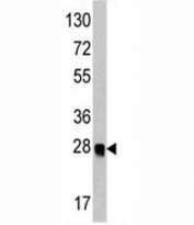Western blot analysis of ATG12 antibody and recombinant protein.