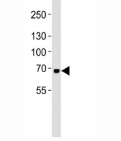 Western blot analysis of lysate from K562 cell line using LTF antibody at 1:1000. Predicted molecular weight: ~78/73kDa (isoforms 1/2). (1)