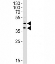 Western blot analysis of lysate from HUVEC cell line using CD34 antibody at 1:1000 for each lane.  Observed in western blot from 41-120kD depending on glycosylation level.