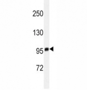 Western blot analysis of EZH2 antibody in T47D lysate. Predicted size: 85-95 kDa