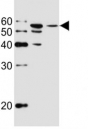 Western blot analysis of lysate from MCF-7, T47D cell line (left to right) using ALDH6A1 antibody at 1:1000 for each lane. Predicted molecular weight: ~58kDa.