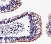 Immunohistochemical analysis of paraffin-embedded human colon section using ALDH6A1 antibody at 1:25 dilution.