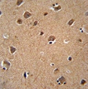 AKT3 antibody immunohistochemistry analysis in formalin fixed and paraffin embedded human brain tissue.