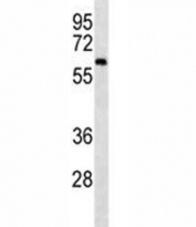 CAMKK2 western blot analysis in mouse cerebellum tissue lysate.