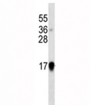 Interferon-alpha western blot analysis in IFN lysate