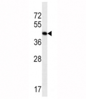 Skeletal muscle Actin antibody western blot analysis in CEM lysate.