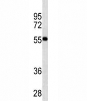 VDR antibody western blot analysis in MDA-MB453 lysate. Predicted molecular weight 48/54 kDa (isoforms 1/2).