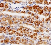 Immunohistochemical analysis of paraffin-embedded human stomach using EGF Receptor antibody at 1:25 dilution.