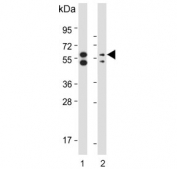 Western blot testing of human 1) HeLa and 2) MCF7 cell lysate with PINK1 antibody. Predicted molecular weight: 60-70 kDa.