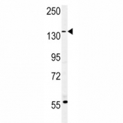 MUC1 antibody western blot analysis in MDA-MB435 lysate. Predicted molecular weight: 120-500 kDa depending on glycosylation level