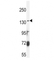 ABCC3 antibody western blot analysis in MDA-MB435 lysate