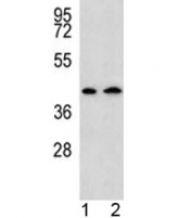 AADAT antibody western blot analysis in human 1) HepG2, and 2) Y79 lysate. Predicted molecular weight: ~47 kDa.