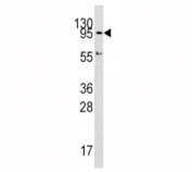 Western blot analysis of Dnmt3a antibody and HepG2 lysate. Predicted molecular weight: 100-130 kDa
