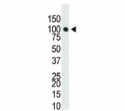 Western blot analysis of Dnmt3a antibody in T47-D cell lysate. Predicted molecular weight: 100-130 kDa