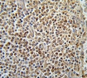 PAX-7 antibody immunohistochemistry analysis in formalin fixed and paraffin embedded human spleen tissue