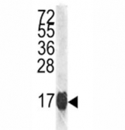 Western blot analysis of Histone H3.1 antibody and HL-60 lysate