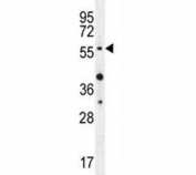 AKT1 antibody western blot analysis in MDA-MB435 lysate