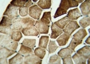 MAP1LC3A immunohistochemistry analysis in formalin fixed and paraffin embedded human skeletal muscle.
