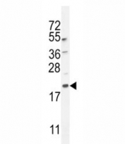 MAP1LC3A western blot analysis in mouse lung tissue lysate