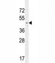CD34 antibody western blot analysis in Jurkat lysate.  Expected size is 41~110 kDa depending on glycosylation level.