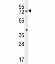 CD31 antibody western blot analysis in mouse bladder tissue lysate