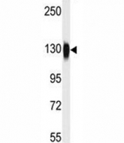 HDAC6 antibody used in western blot to detect HDAC6 in mouse kidney tissue lysate. Expected molecular weight 130~160kDa.