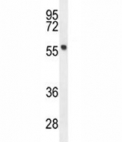 FEZF1 antibody western blot analysis in mouse stomach tissue lysate. Predicted molecular weight ~ 52 kDa.