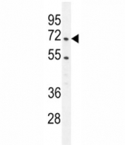 PRMT4 antibody western blot analysis in Jurkat lysate.