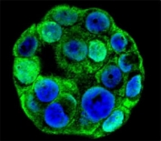 Confocal immunofluorescent analysis of SP1 antibody with WiDr cells followed by Alexa Fluor 488-conjugated goat anti-rabbit lgG (green). DAPI was used as a nuclear counterstain (blue).