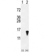 Western blot analysis of ISG15 antibody and 293 cell lysate (2 ug/lane) either nontransfected (Lane 1) or transiently transfected with the ISG15 gene (2). Expected molecular weight: 15-17 kDa.